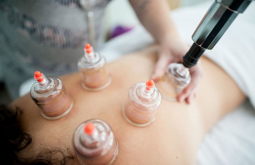a woman performing cupping treatment on another woman's back cupping therapist as one of the best beauty side hustles